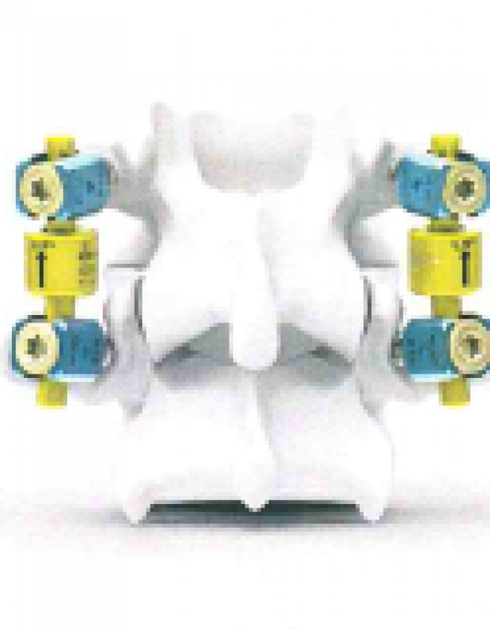 B-DYN System